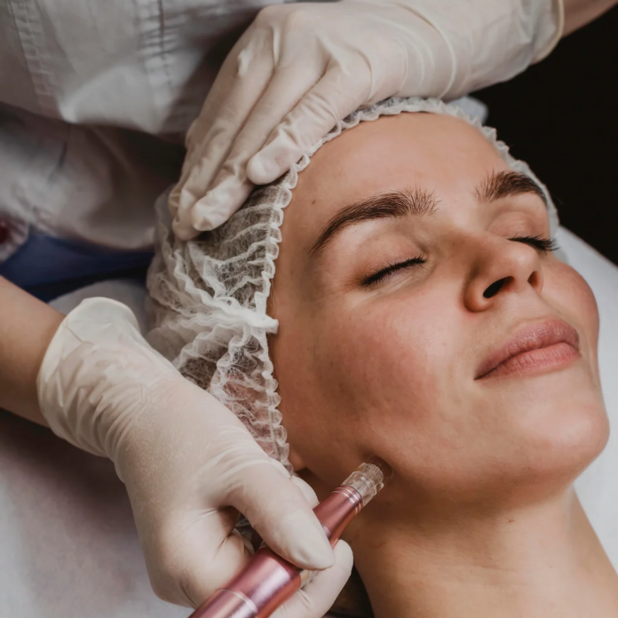 Microneedling Buy 3 get 1 free